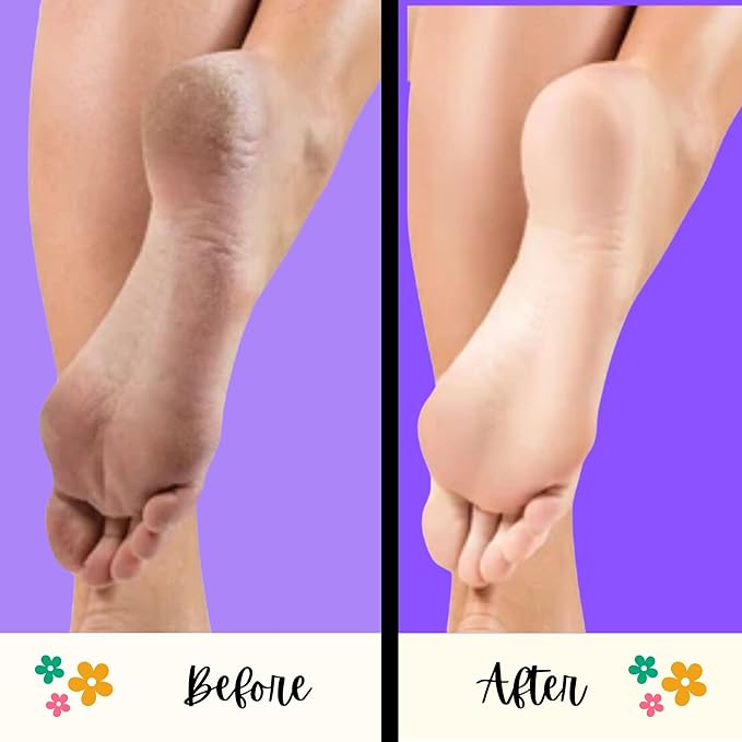 Mr. Pumice - Ultimate PUMI Bar: 2-in-1 Dual-Grit (Extra Coarse | Medium)